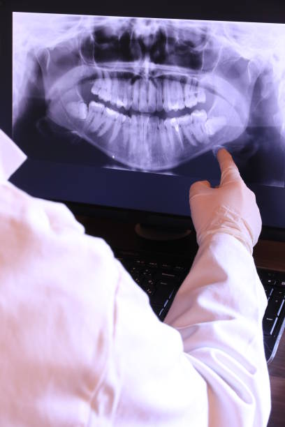 Best Emergency Wisdom Teeth Removal in Mcewen, TN